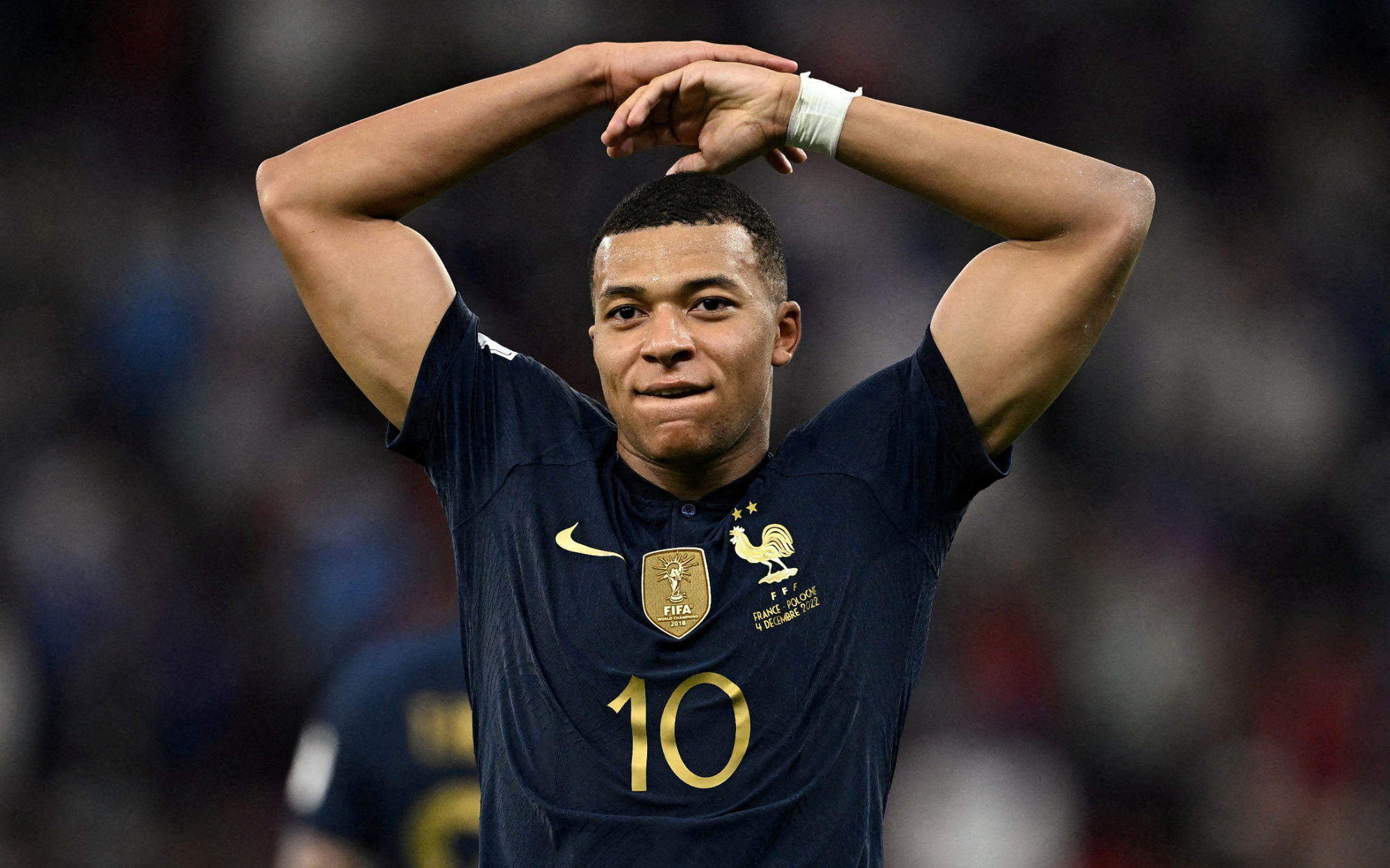 Cầu thủ Brazil chấn thương nặng vì bắt chước Ronaldo - Ảnh 1.