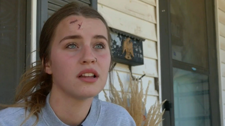 Vật thể lạ bay trúng đầu cô gái đang chờ chơi tàu lượn - Ảnh 1.