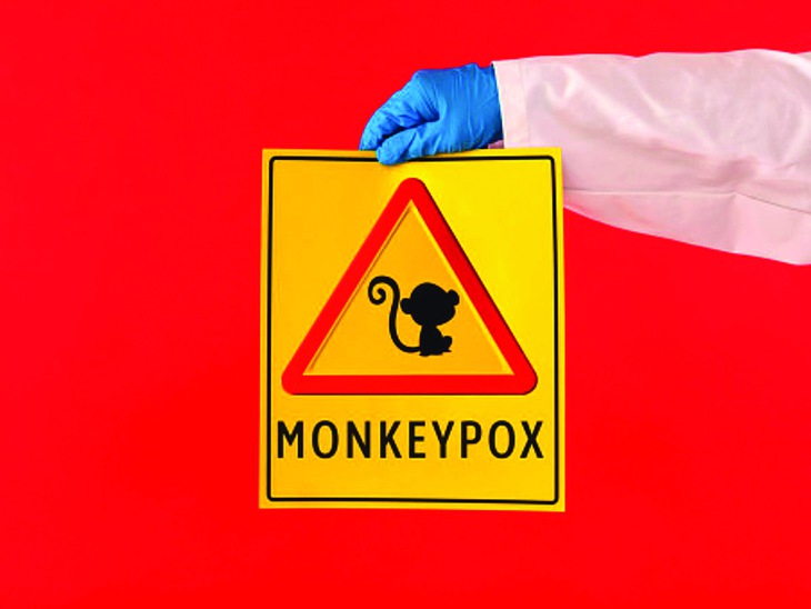 Không đậu mùa khỉ thì là gì? - Ảnh 1.