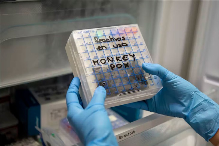 Không đậu mùa khỉ thì là gì? - Ảnh 2.