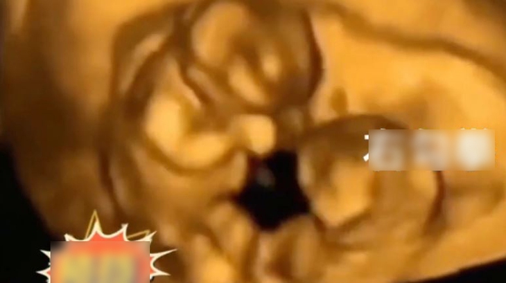 Thực hư đoạn clip cặp sinh đôi kung-fu trong bụng mẹ - Ảnh 1.