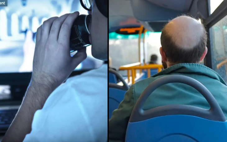 Đàn ông hói đầu có phải do 