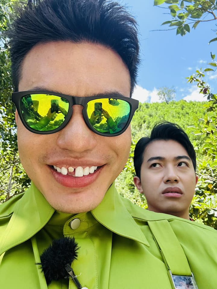 "Chàng hề" đến từ Đồng Nai hào hứng khoe chiến tích với hàm răng sứ trứ danh