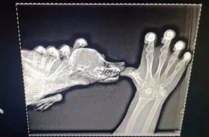 Ảnh chụp X-quang "chất lượng cao".