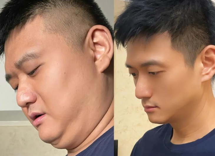 Giảm cân là phương pháp "phẫu thuật thẩm mỹ" hiệu quả nhất.