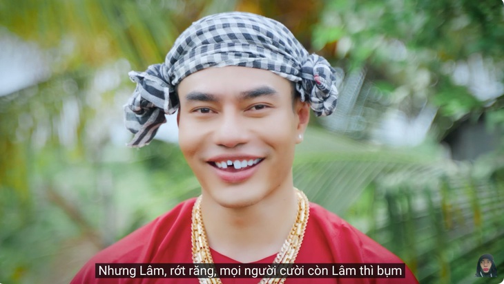 Không quên "nhắc" hình ảnh rớt răng trứ danh của chính mình