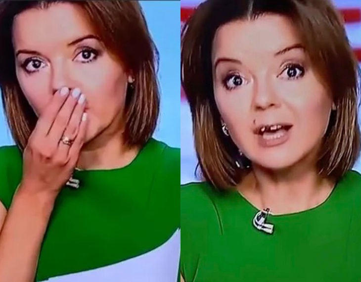 MC Ukraine cũng từng gặp sự cố rơi răng khi đang dẫn dắt chương trình