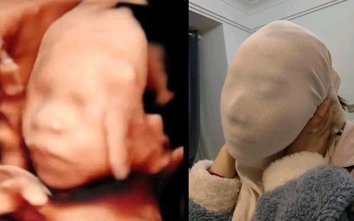 Ảnh vui 15-11: Cách để biết bé giống mẹ hay giống ba