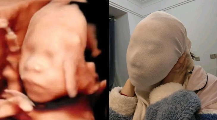 Cách này tôi xin phép được "cười".