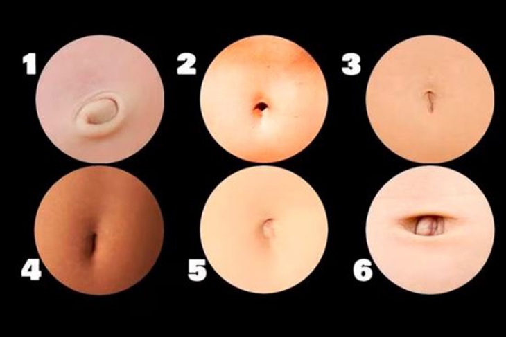 Hình dạng lỗ rốn tiết lộ tính cách của bạn - Ảnh 1.