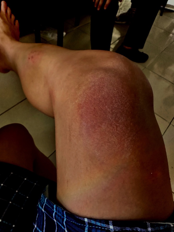 Sự cố nhớ đời của "cô giáo Khánh"&nbsp;