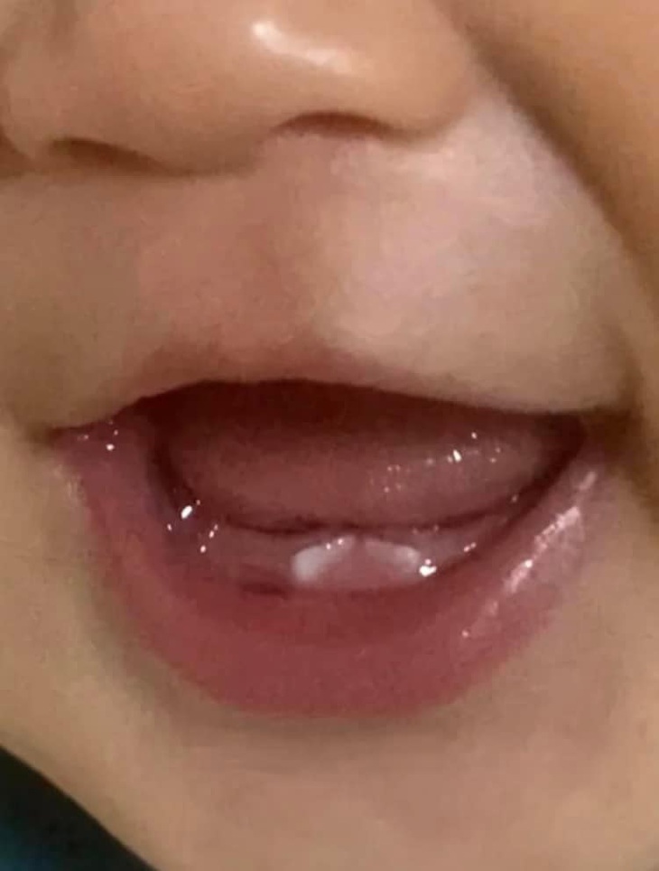 Nhìn phát đoán trước tương lai: Tốn tiền niềng răng.