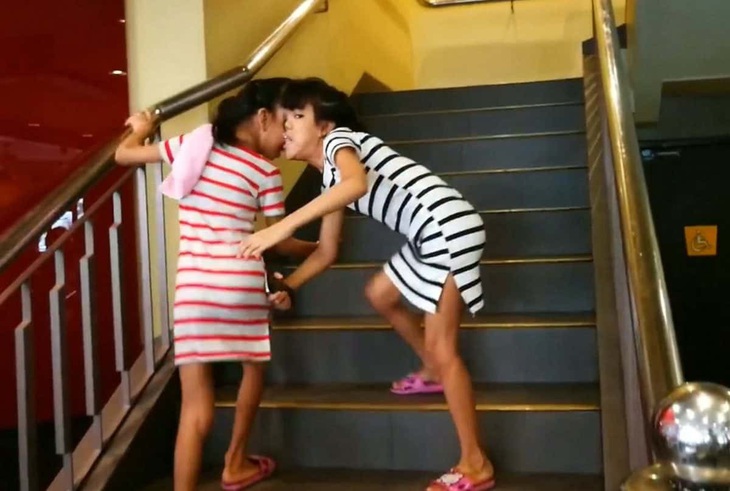 Khoảnh khắc cặp song sinh dính liền đầu 'đốn tim' dân mạng - Ảnh 2.