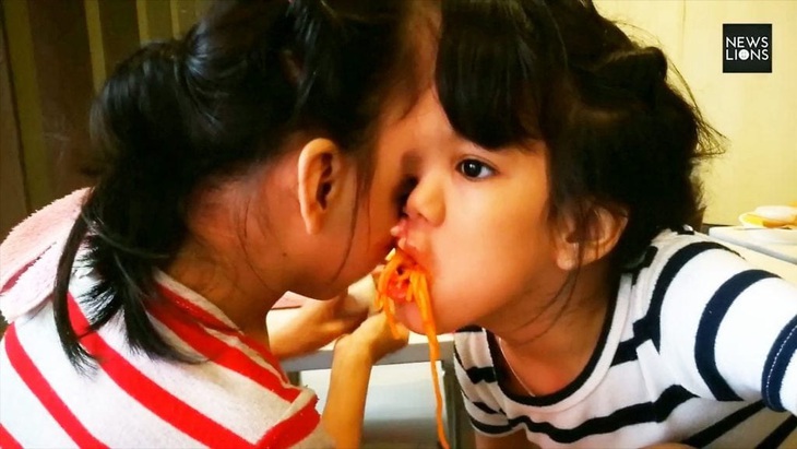 Khoảnh khắc cặp song sinh dính liền đầu 'đốn tim' dân mạng - Ảnh 5.