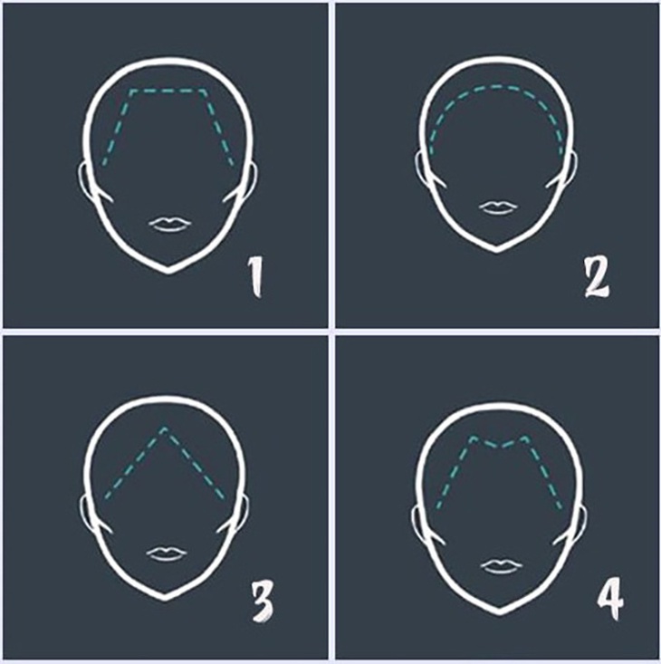 Đường viền tóc tiết lộ điểm yếu, điểm mạnh của bạn- Ảnh 1.