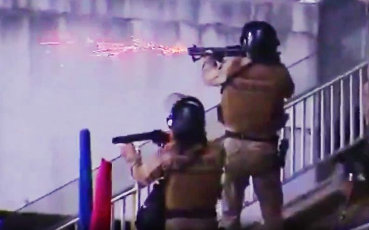 Đấm hụt đối thủ, cầu thủ Argentina bị phản đòn gãy răng - Ảnh 3.