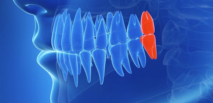 Răng miệng đau, thân thể mệt- Ảnh 3.