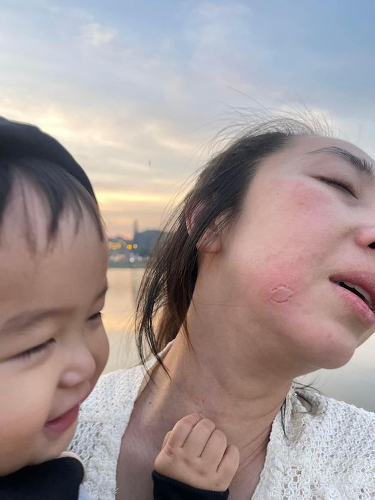 Khi con gái đến tuổi "ngứa răng". 