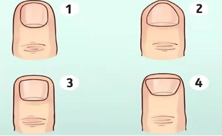 Dự đoán vận mệnh tài lộc của bạn qua hình dáng móng tay- Ảnh 1.