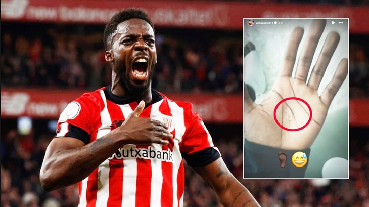Inaki Williams vẫn ra sân thường xuyên tại La Liga với mảnh thủy tinh ở bàn chân suốt 2 năm - Ảnh: Getty