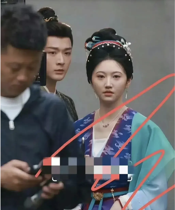 Cảnh Điềm với gương mặt sưng vù, khác xa những bức ảnh mỹ miều thường thấy