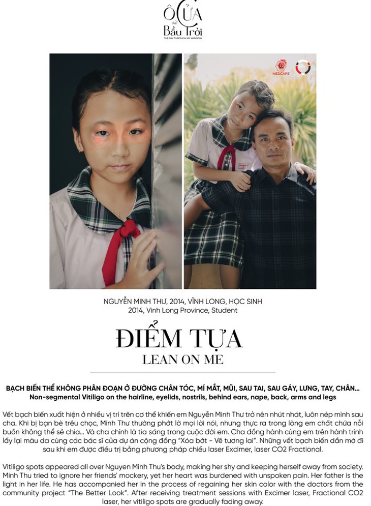 Câu chuyện của bé Minh Thư trong sách ảnh Ô cửa và bầu trời.