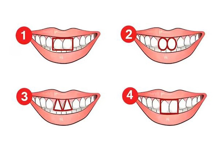 Quiz: Khám phá tính cách tiềm ẩn qua hình dạng răng cửa của bạn- Ảnh 1.