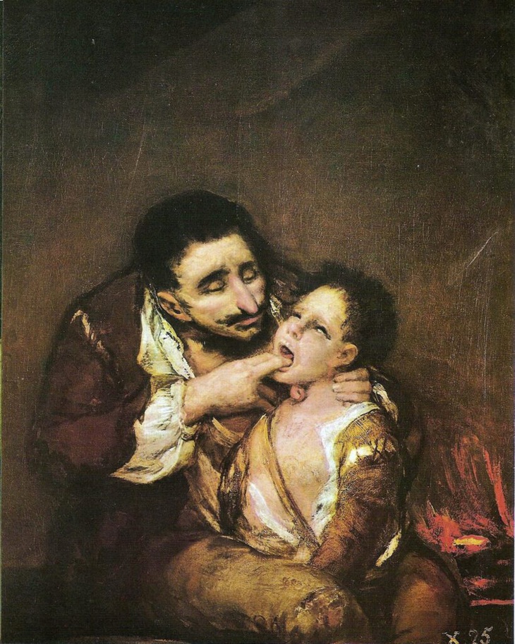 Bệnh bạch hầu: Cơn ác mộng vẫn chưa có hồi kết- Ảnh 2.