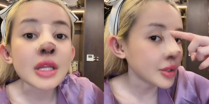 Hình ảnh Ngân 98 trước phẫu thuật thẩm mỹ được chia sẻ rần rần - Ảnh 3.