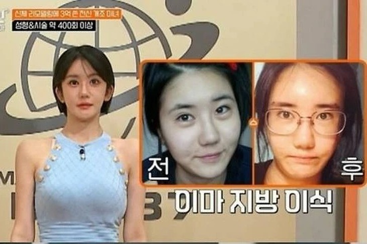 thẩm mỹ - Ảnh 1.