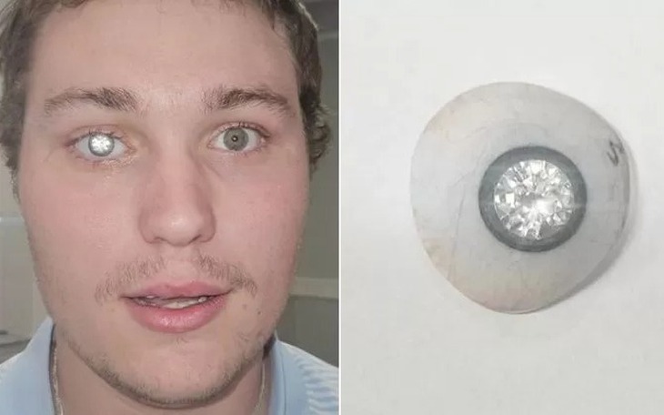 Trúng số độc đắc hai nơi: cùng một dãy số, cùng một… người! - Ảnh 5.