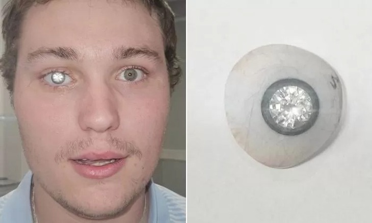 kim cương - Ảnh 1.