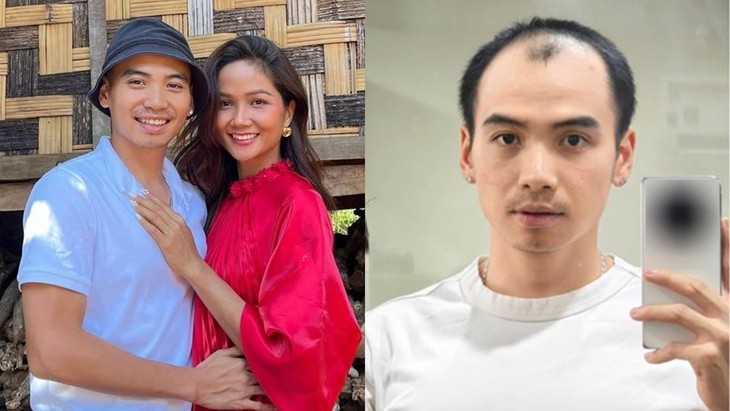 Diện mạo chồng H'Hen Niê sau 5 tháng trị hói đầu   - Ảnh 1.