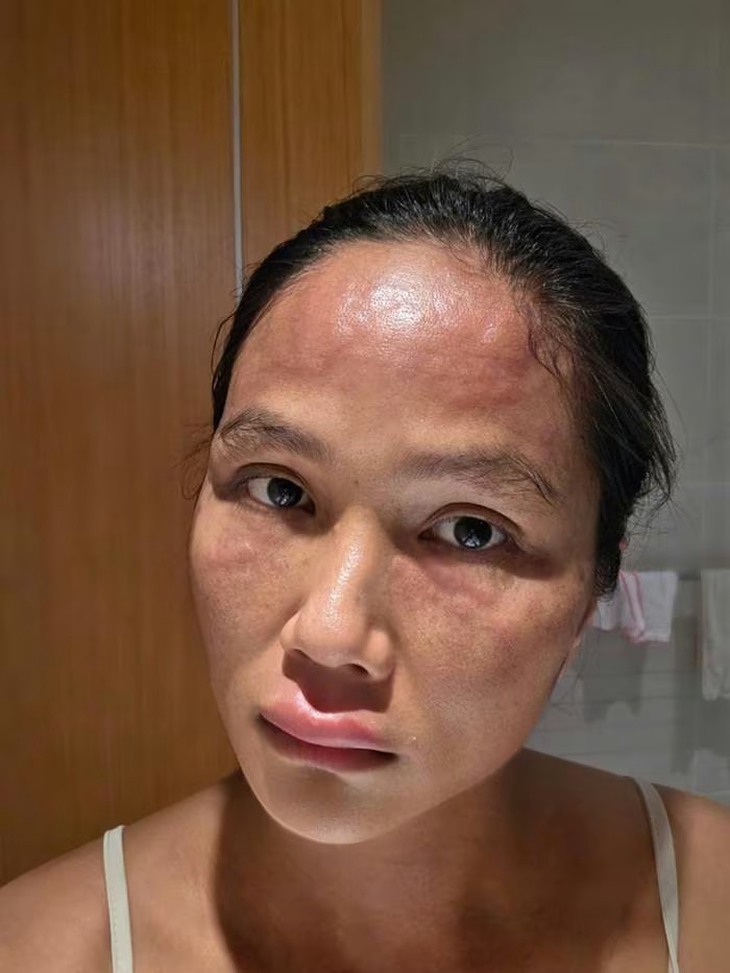 H'Hen Niê gặp rắc rối sức khỏe sau sinh, Ngọc Hân đồng cảm vì từng trải qua - Ảnh 1.