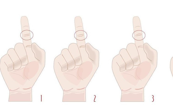 Quiz: Vận may nào đang mỉm cười với bạn? - Ảnh 3.