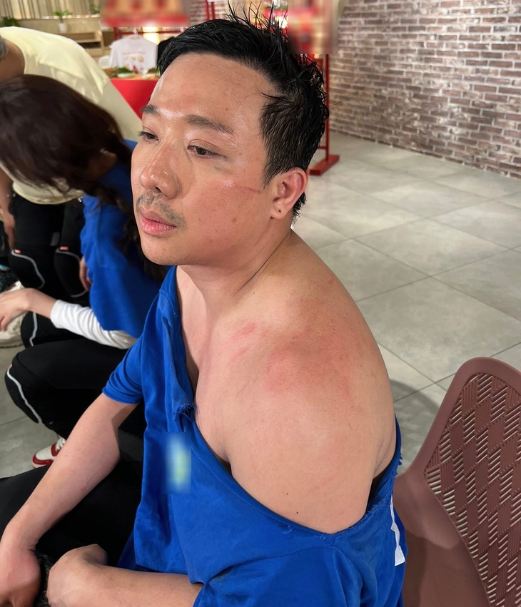 Trấn Thành - Ảnh 1.