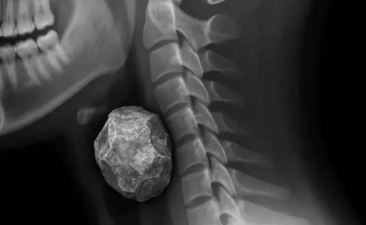 rắn cạp nia - Ảnh 5.