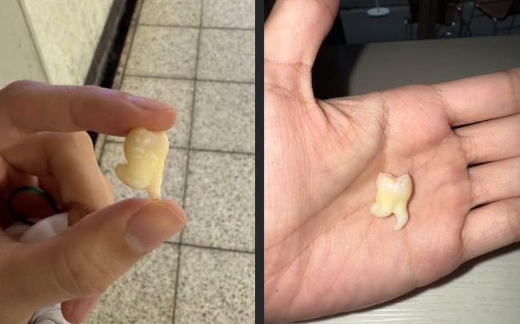 Cố ăn 130 cái bánh bột lọc ở sân bay vì không được mang sang Nhật và cái kết - Ảnh 5.