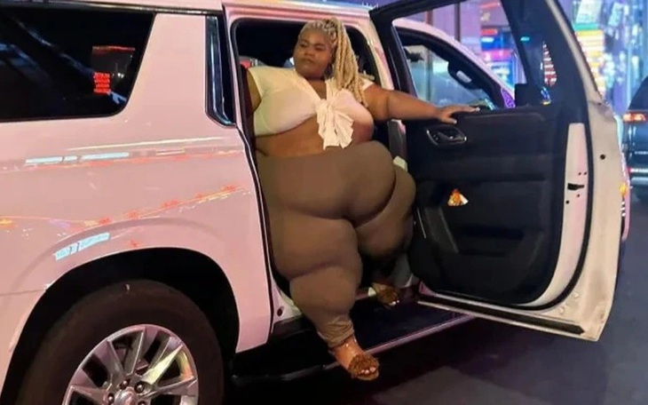 Tại sao Erling Haaland 'khóa mỏ' khi đi ngủ? - Ảnh 2.