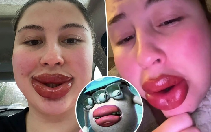 Tại sao Erling Haaland 'khóa mỏ' khi đi ngủ? - Ảnh 3.