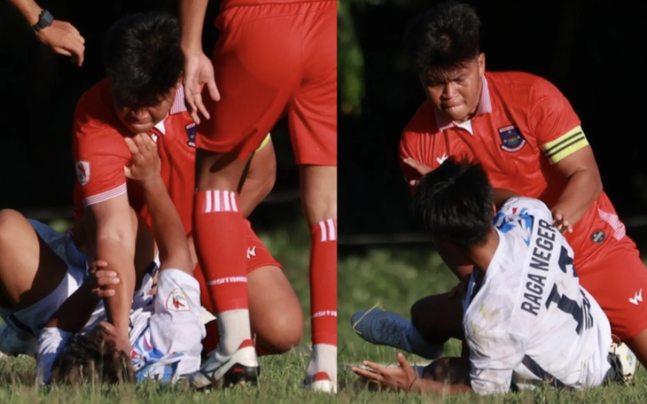 Thẩm mỹ xong đẹp quá làm mất hết bạn bè - Ảnh 3.