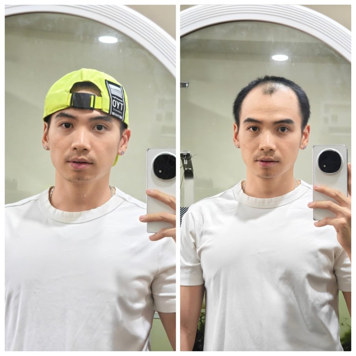 Chồng H’Hen Niê 'khoe' ảnh đầu hói - Ảnh 1.