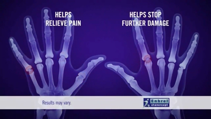 Quảng cáo dược phẩm trên truyền hình: Biết tai hại nhưng khó cấm - Ảnh 3.