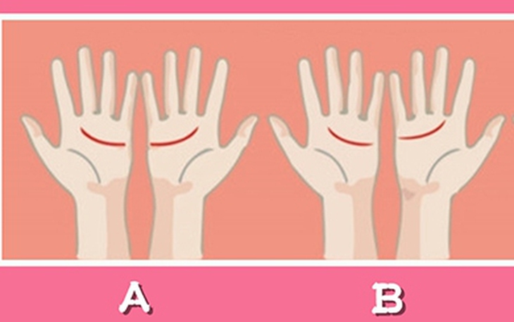 Quiz: Bạn là người bình thản hay luôn lo lắng về tương lai? - Ảnh 3.