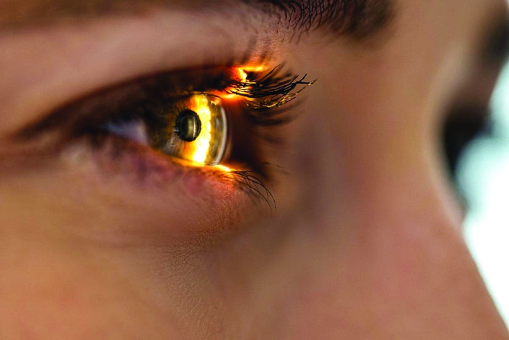 ô nhiễm không khí - Ảnh 1.