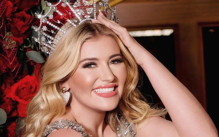 Người đẹp nào sẽ thi Miss World 2026? - Ảnh 3.