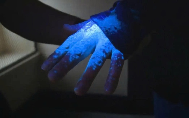 Nữ cầu thủ ‘xinh như tranh vẽ AI’ Madelene Wright bị thương vì nhện - Ảnh 3.