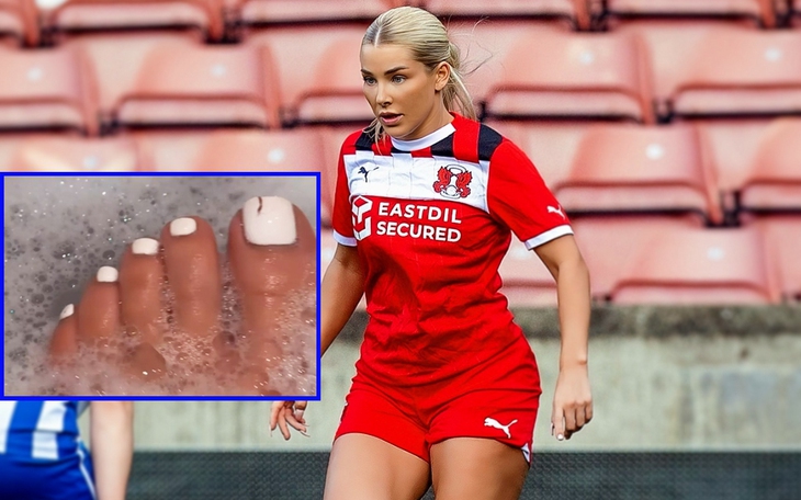 Cầu thủ Bolivia bị thương vùng kín vì pháo sáng 'tên lửa' - Ảnh 4.