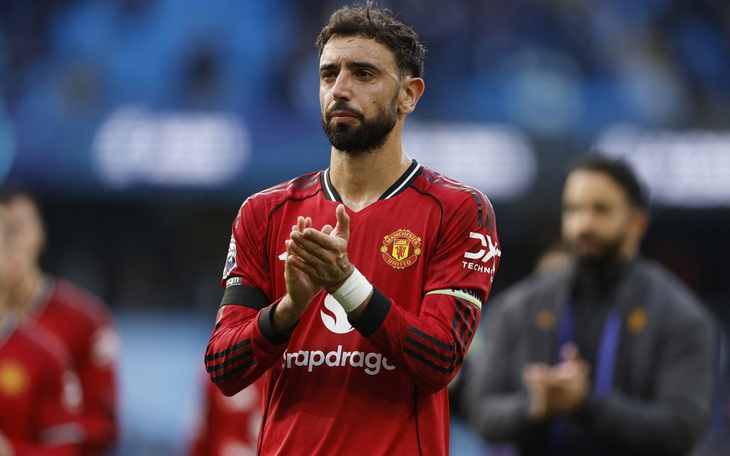 Fan rần rần phát hiện sao Man Utd cấy tóc - Ảnh 2.