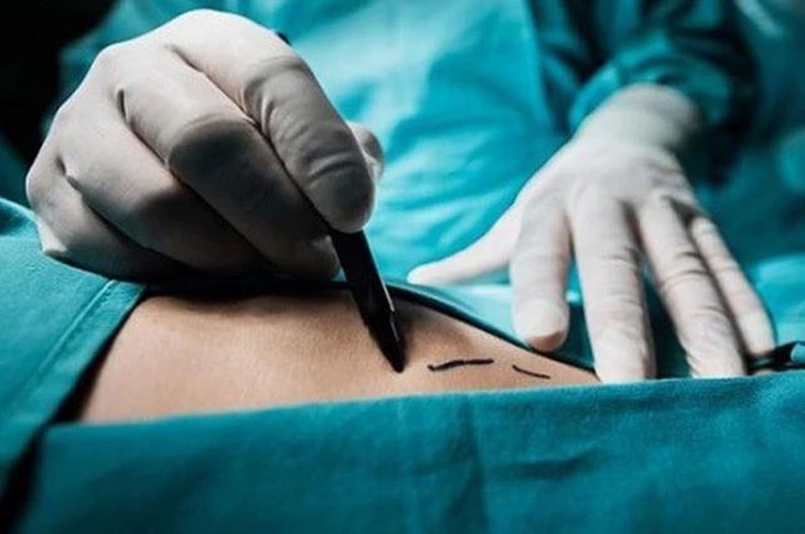 Chuyện chàng trai bán thận mua iPhone rộ lại trên cõi mạng, giờ ra sao? - Ảnh 3.